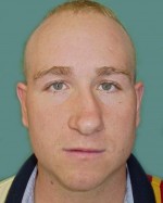 Nose Surgery (Rhinoplasty)