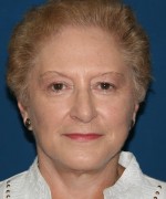 Face Lift