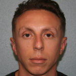Nose Surgery (Rhinoplasty)