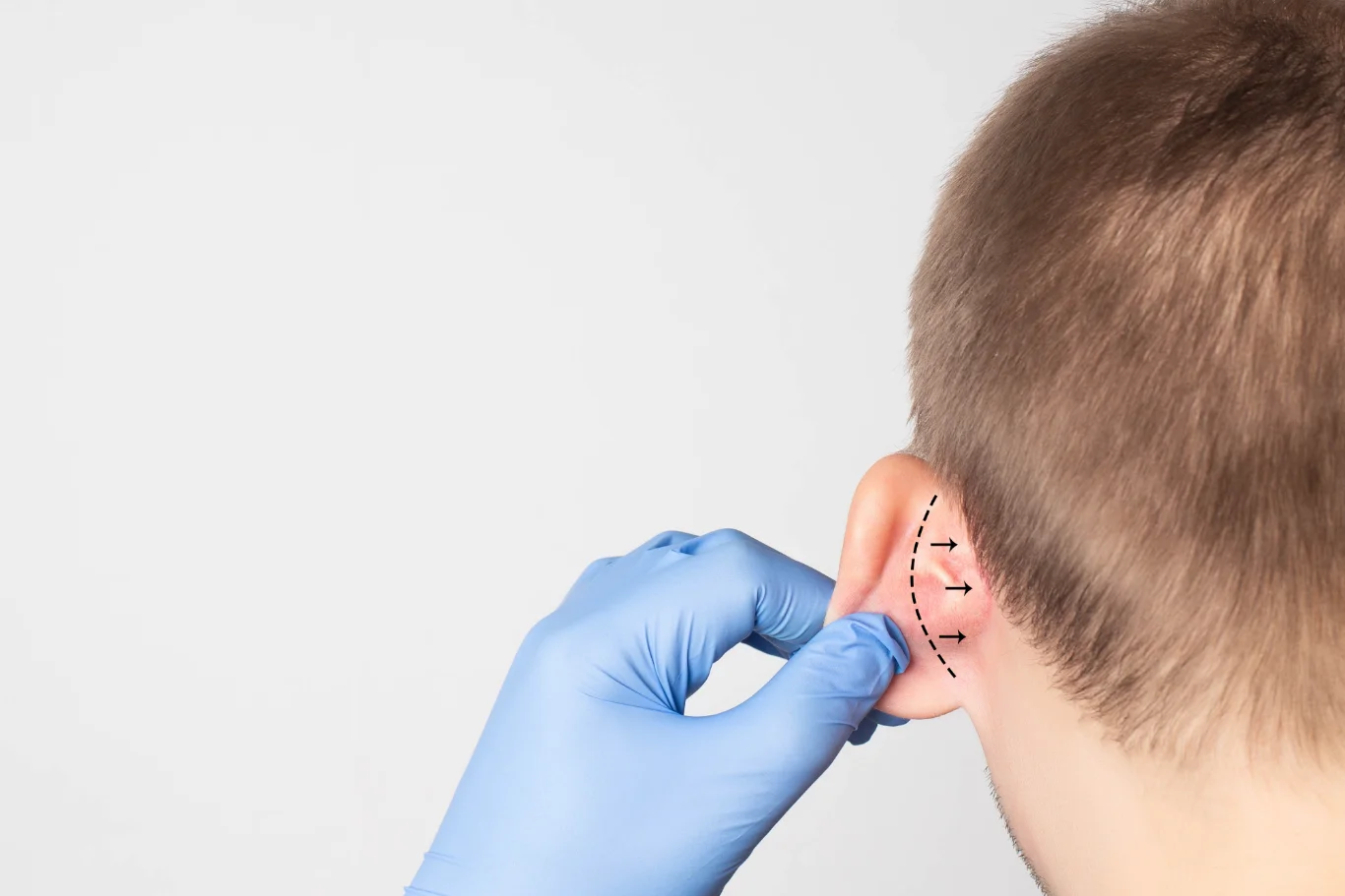 A plastic surgeon doctor examines a male patients ear for an otoplasty operation