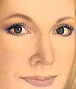 Eyelid Surgery (Blepharoplasty) 4 blepharoplasty-4