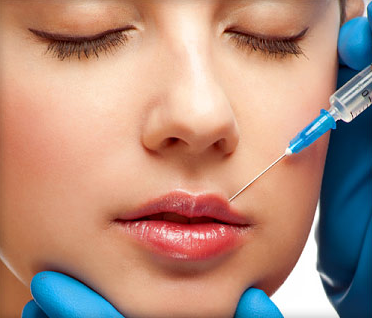 Lip injections augmentation with fillers Juvederm